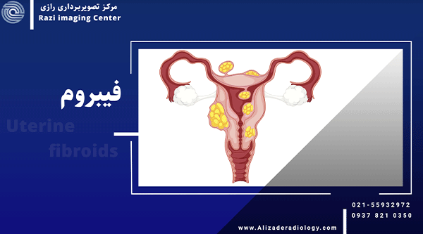 فیبروم چیست؟