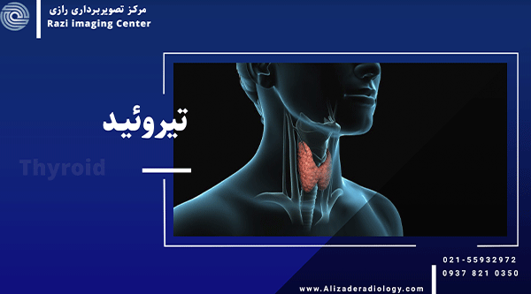 تیروئید چیست؟