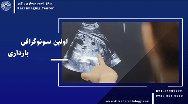 اولین سونوگرافی بارداری را در هفته چندم باید انجام شود؟