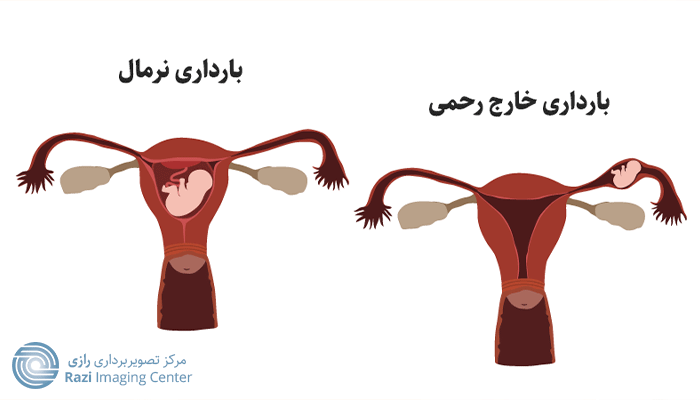 در سونوگرافی سه ماهه اول چه مواردی بررسی می شود؟