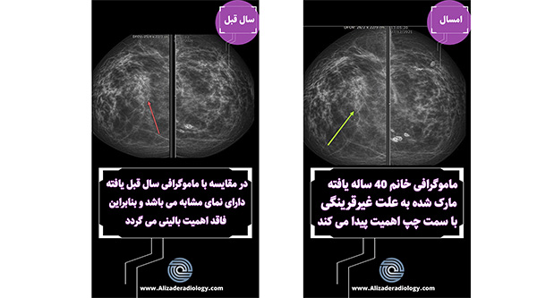 اهمیت نگهداری تصاویر ماموگرافی