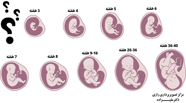 متفاوت بودن سن جنین در سونوگرافی NT و سه ماهه سوم
