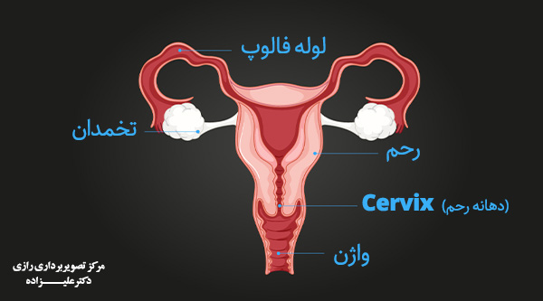 سونوگرافی بررسی طول Cervix