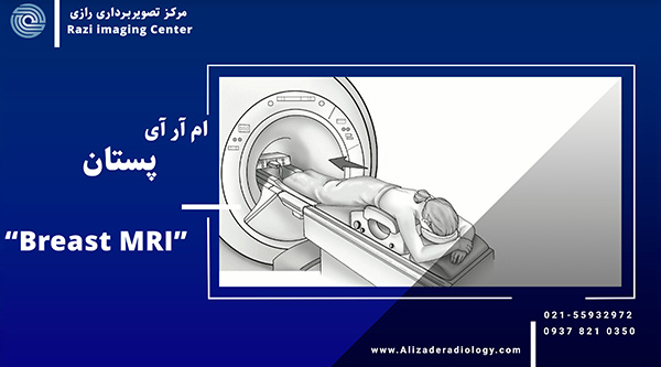 ام آر آی پستان چیست؟ | MRI سینه در بهترین مرکز تصویربرداری تهران