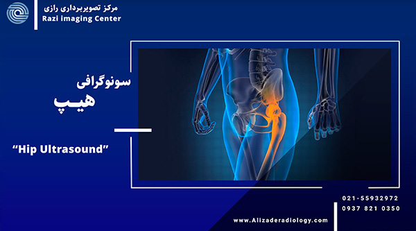 سونوگرافی هیپ | سونوگرافی هیپ نوزادان | سونوگرافی هیپ در تهران