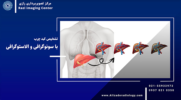 تشخیص کبد چرب با سونوگرافی و الاستوگرافی