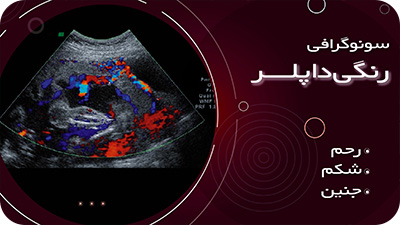 سونوگرافی رنگی داپلر در شهرری