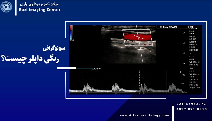 سونوگرافی رنگی داپلر چیست؟ | راهی برای تشخیص سریع و دقیق خونرسانی