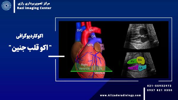  اکوی قلب جنین + زمان انجام اکوکاردیوگرافی + واژینال یا شکمی؟