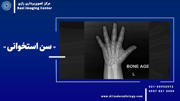 سن استخوانی چیست و چرا انجام می شود؟