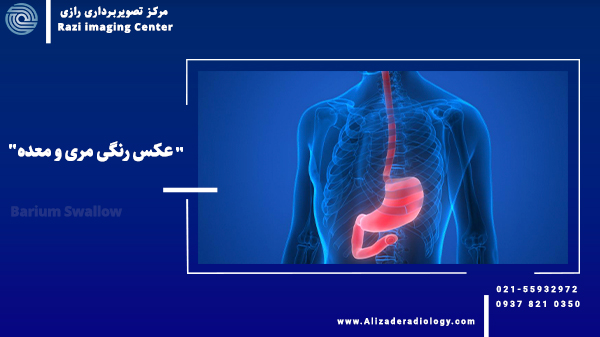 باریوم سوالو | عکس رنگی مری و معده