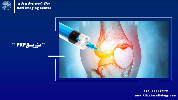 کاربرد PRP در مشکلات مفصلی